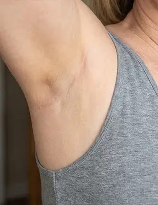 Under Arms After