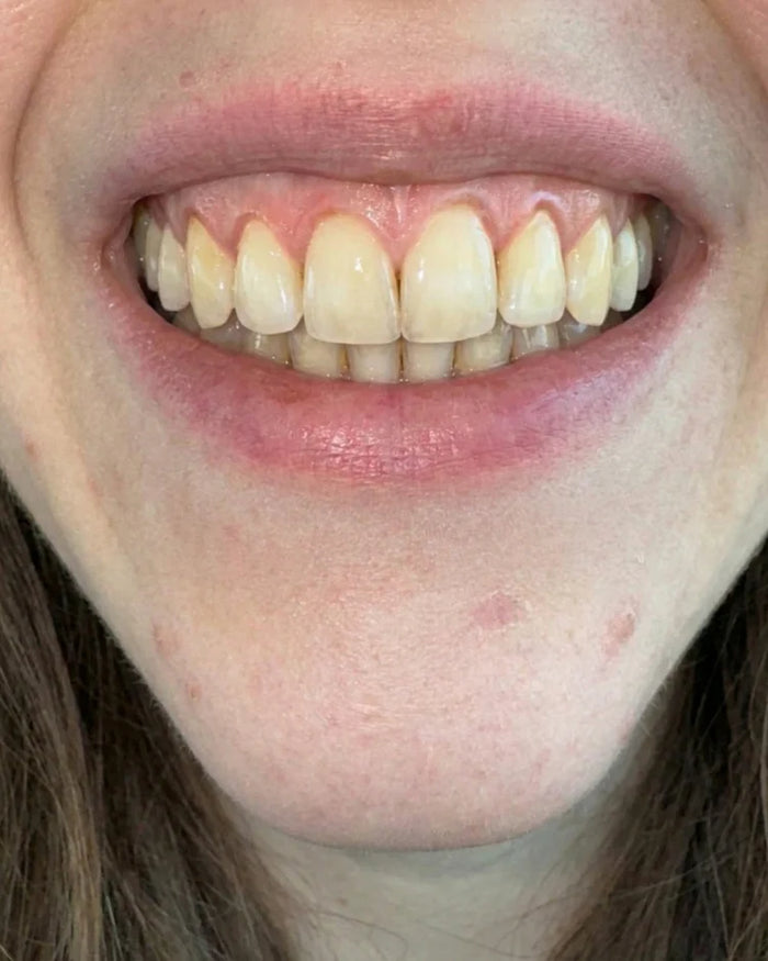 Before