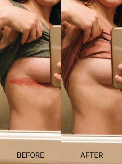 Sundaye® Anti-chafing Stick