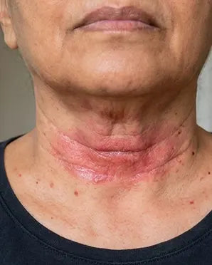 Neck Fold