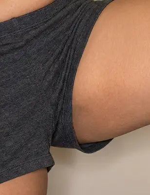 Groin Area After
